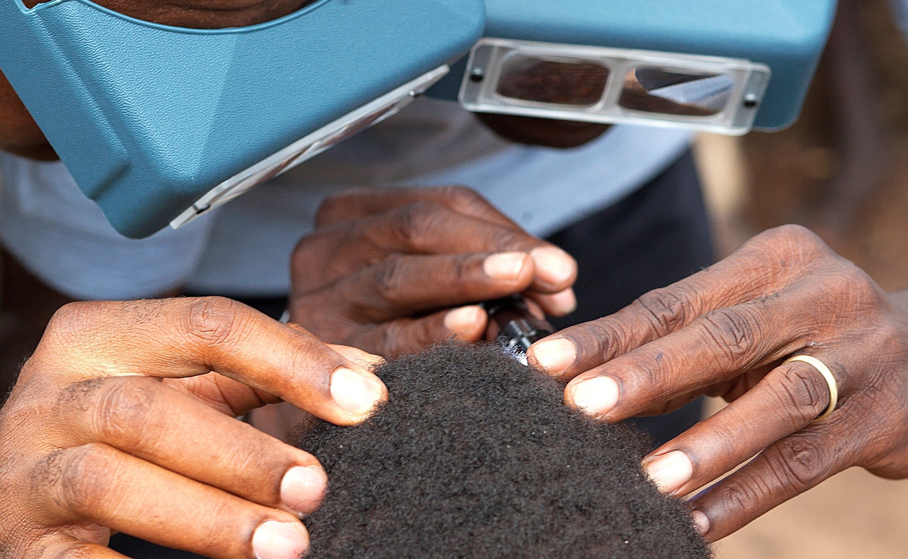 Two graders conferring during eye examination, Togo, 2017, illustrating the level of rigor applied to establishing the prevalence of trachoma nationally.