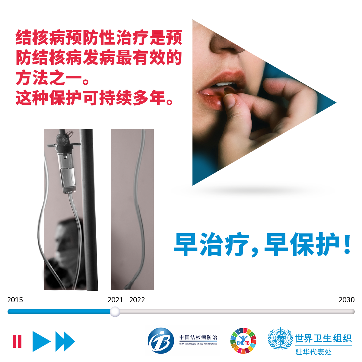 World TB Day 2021