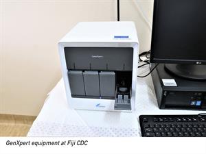 genexpert 1©WHO JIN NI copy